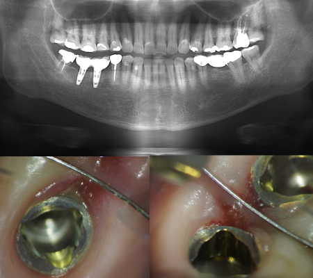 和泉市/くぼ歯科マイクロスコープ