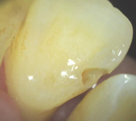 和泉市/くぼ歯科マイクロスコープ